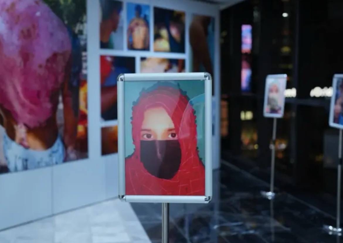 曼谷外国记者协会正在举办一场展览，讲述缅甸妙瓦底诈骗园区受害者遭遇的虐待